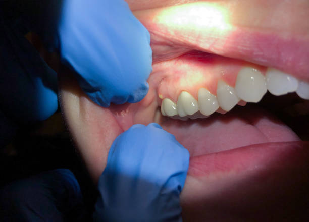 Emergency Gum Pain Relief in WI